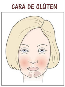 Cara de glúten, estética facial em lisboa SP Clinic. Efeitos do glúten na pele do rosto