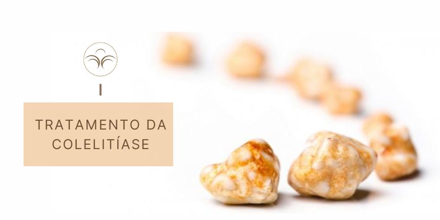 Tratamento-colelitiase-pedras-vesicula-lisboa