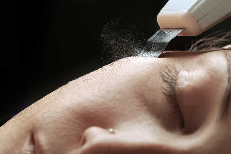 Clinica de limpesa de pele facial com peeling ultrassónico em Lisboa