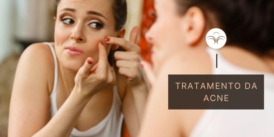 Tratamento da Acne em Lisboa