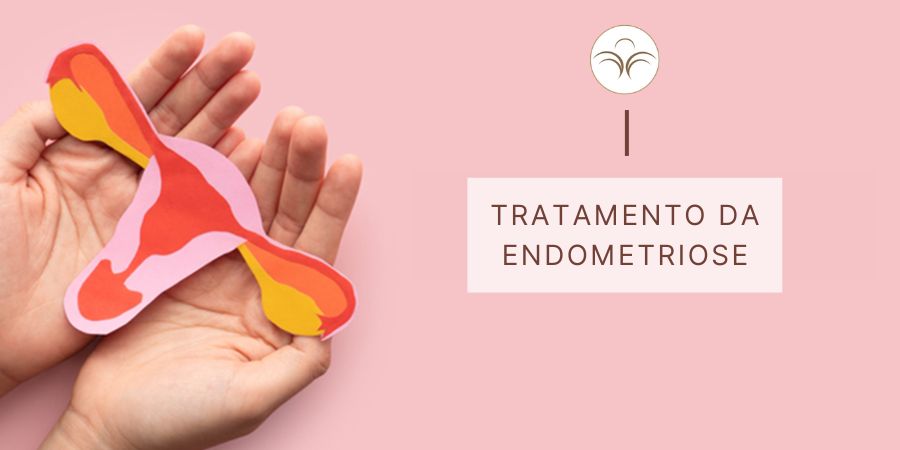 Tratamento-Endometriose-Lisboa