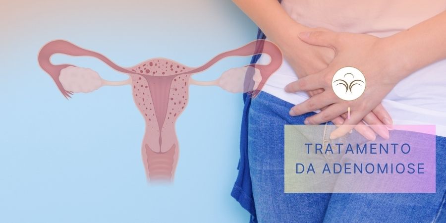 Tratamento-Adenomiose-Lisboa